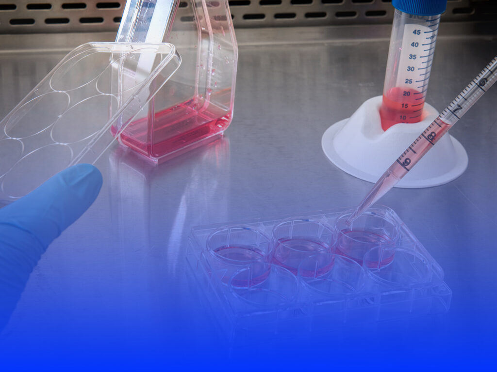 Regulatory_auditorias_gap_analysis2